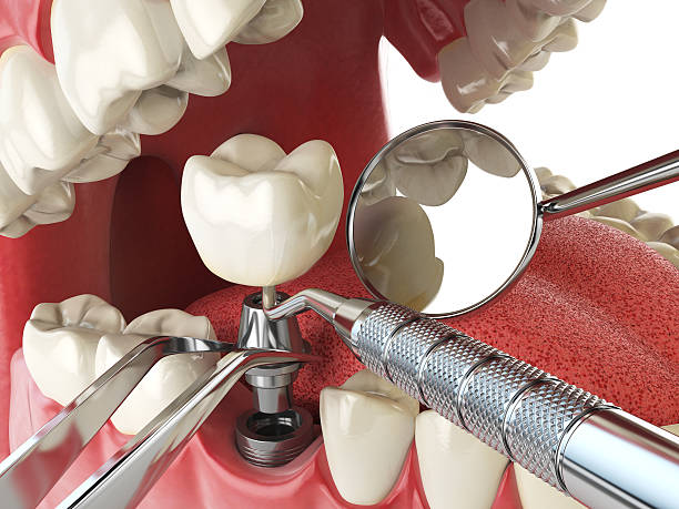 Best Emergency Denture Repair in Lexington, MS